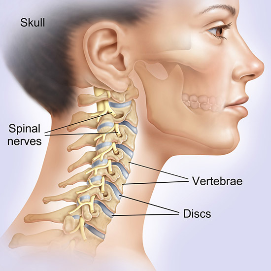 Cervical Disc Replacement Joliet IL | Cervical Spine Fusion Surgery Munster  IN